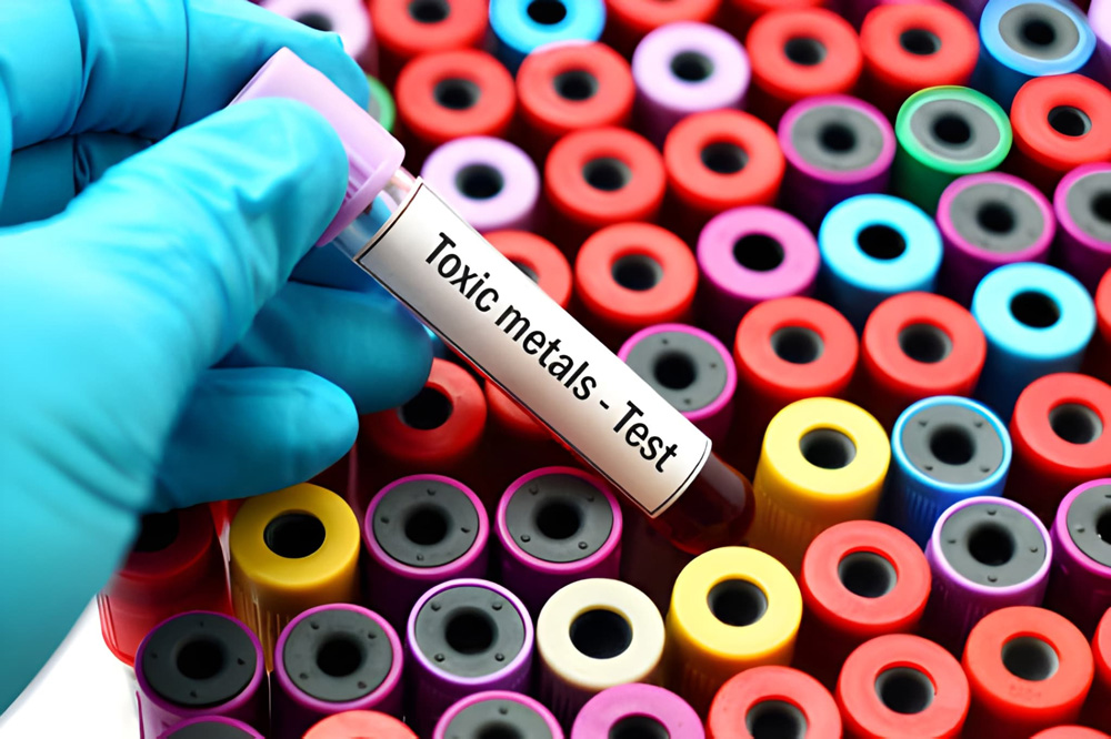 Blood sample labeled toxic metals test